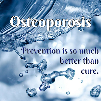 How to Prevent Osteoporosis