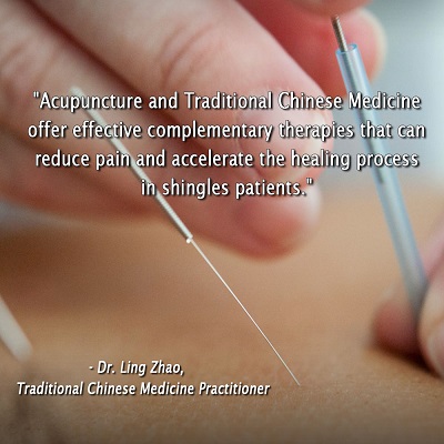 Acupuncture and Traditional Chinese Medicine for Shingles